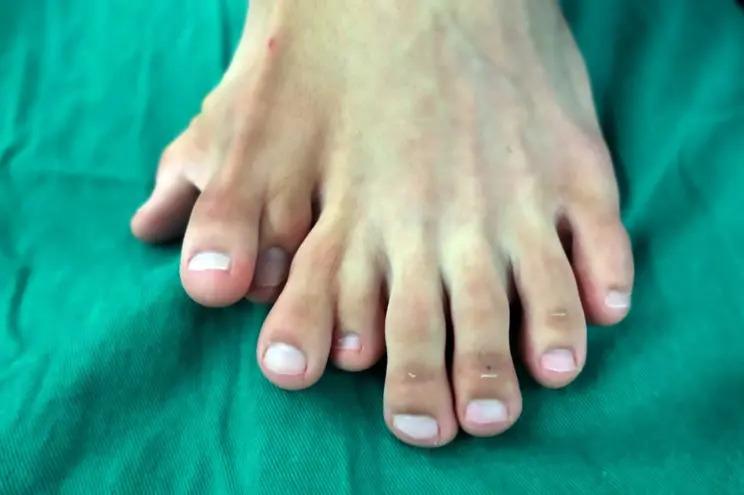 nine-toes-19.jpg