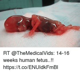 rt-themedicalvids-14-16-weeks-human-*****-https-t-co-enuidkfmbl-29992079.png