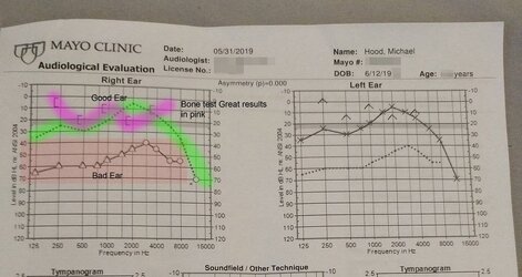 Hearing-test2.jpg