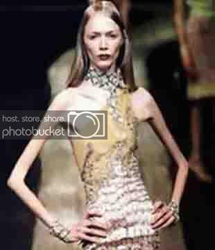 anorexia67aa.jpg