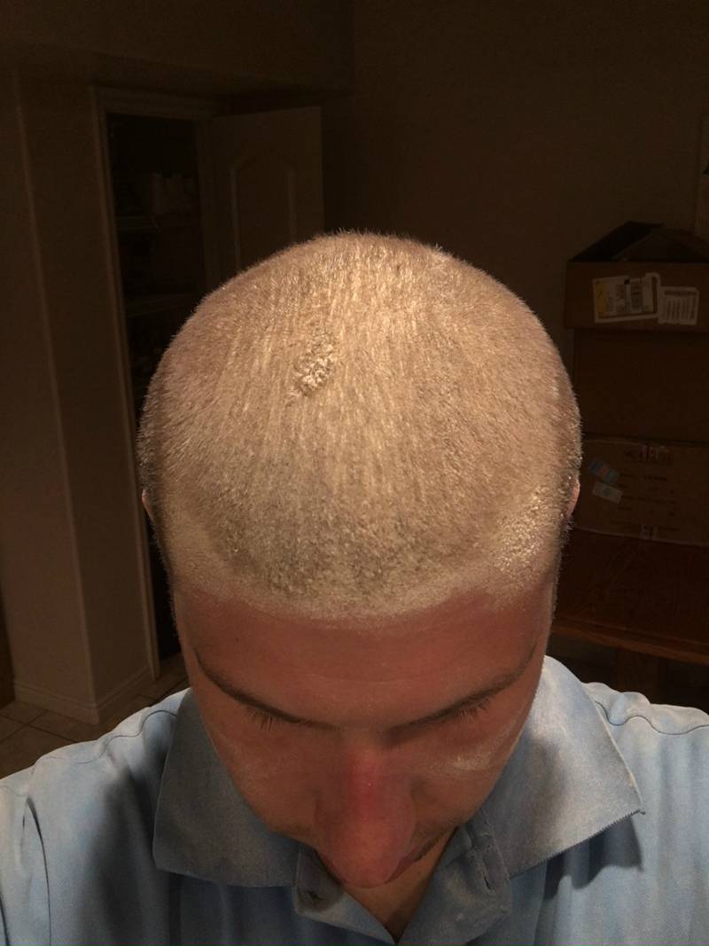 hCfUE0P.jpg