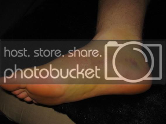 Footafter7days1.jpg