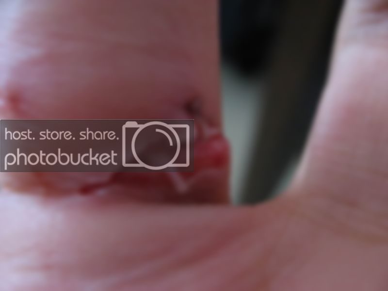 ouch005.jpg