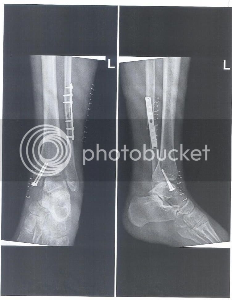 x-ray001-1.jpg