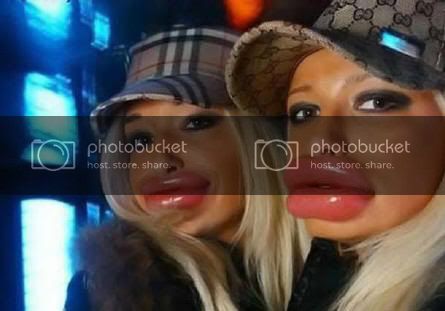 big-lips.jpg