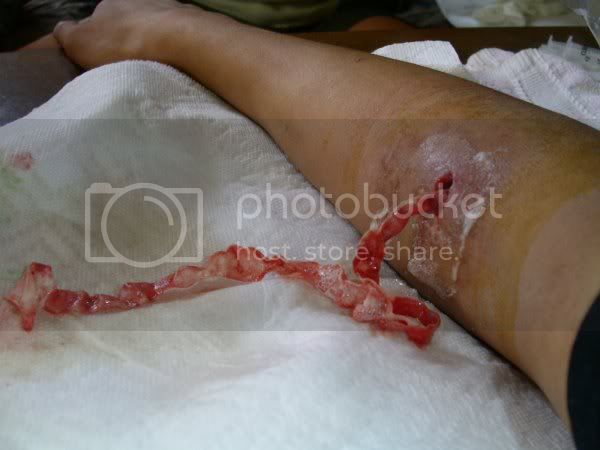 PICT1102.jpg