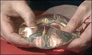 _755103_implant.jpg