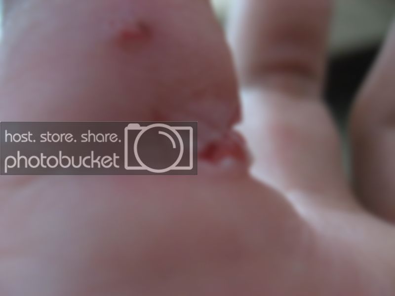 ouch002-2.jpg