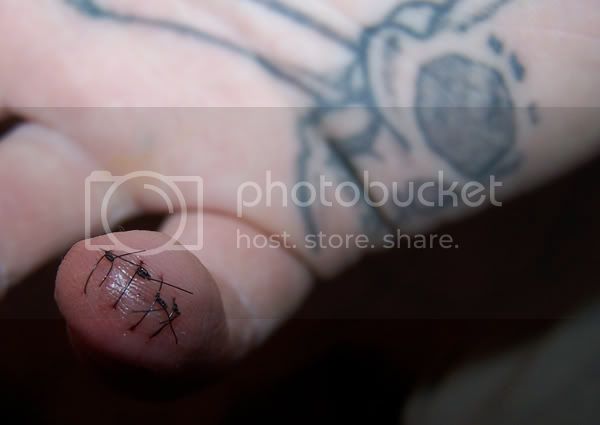 stitches.jpg