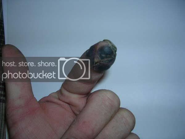 finger05.jpg
