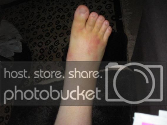 Foot3.jpg
