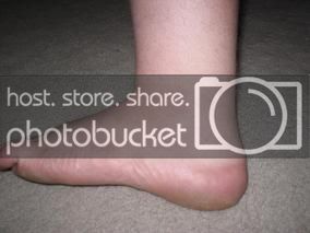 NormalFoot2.jpg