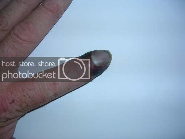 finger01.jpg