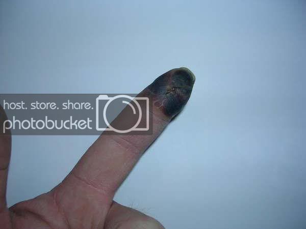 finger03.jpg