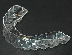 essix_retainers.jpg