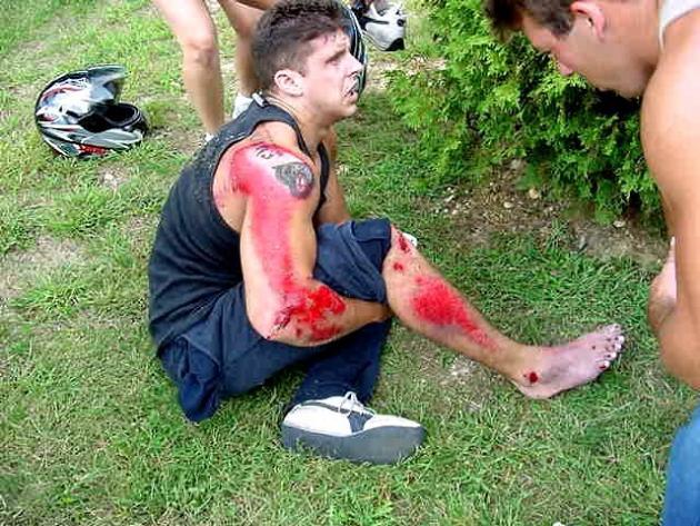 road_rash1.jpg