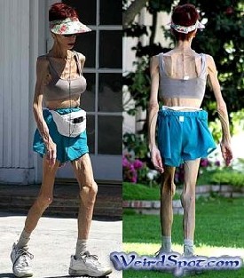 VerySkinnyWoman.jpg