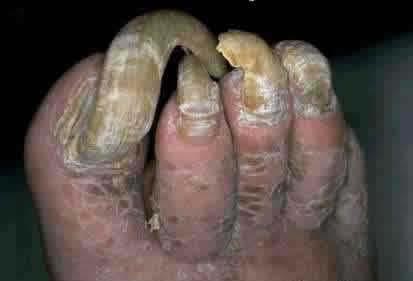 foot.bmp.jpg