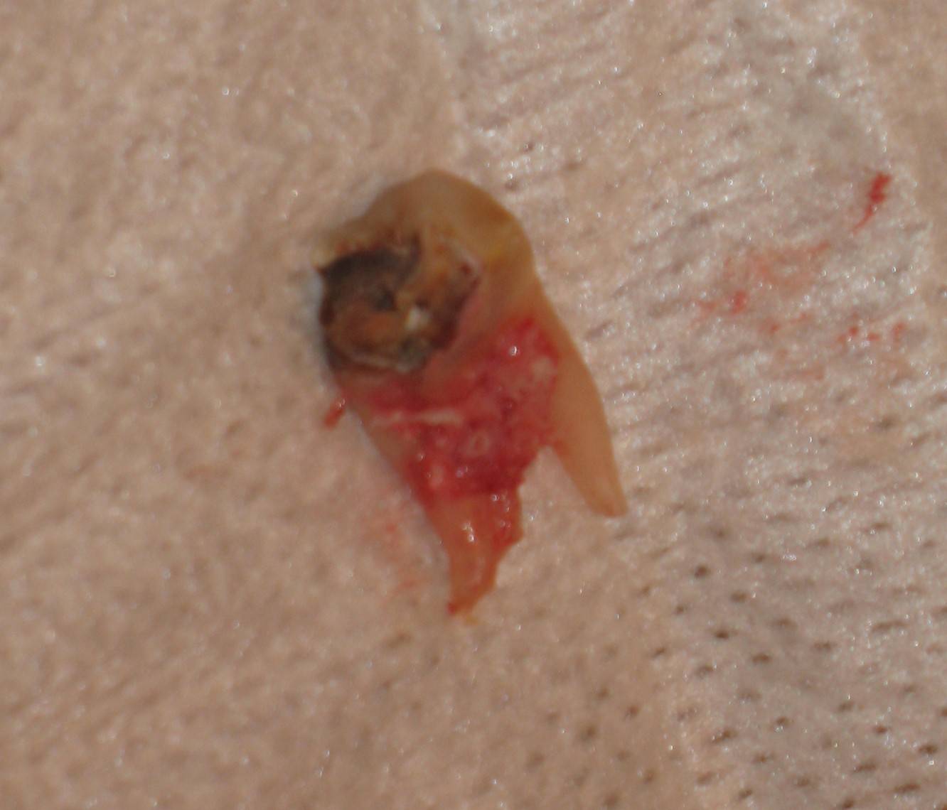 tooth.jpg