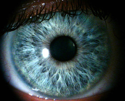 400px-Ray_eye.jpg