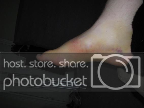 Foot4.jpg