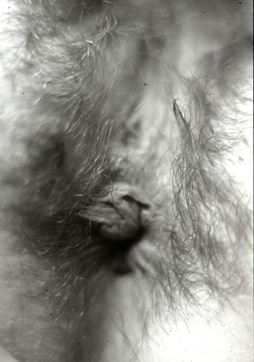 Sphincter-1.jpg