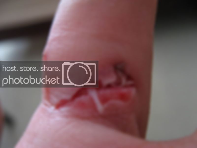 ouch001-2.jpg