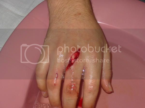 hand.jpg