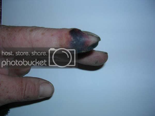 finger02.jpg