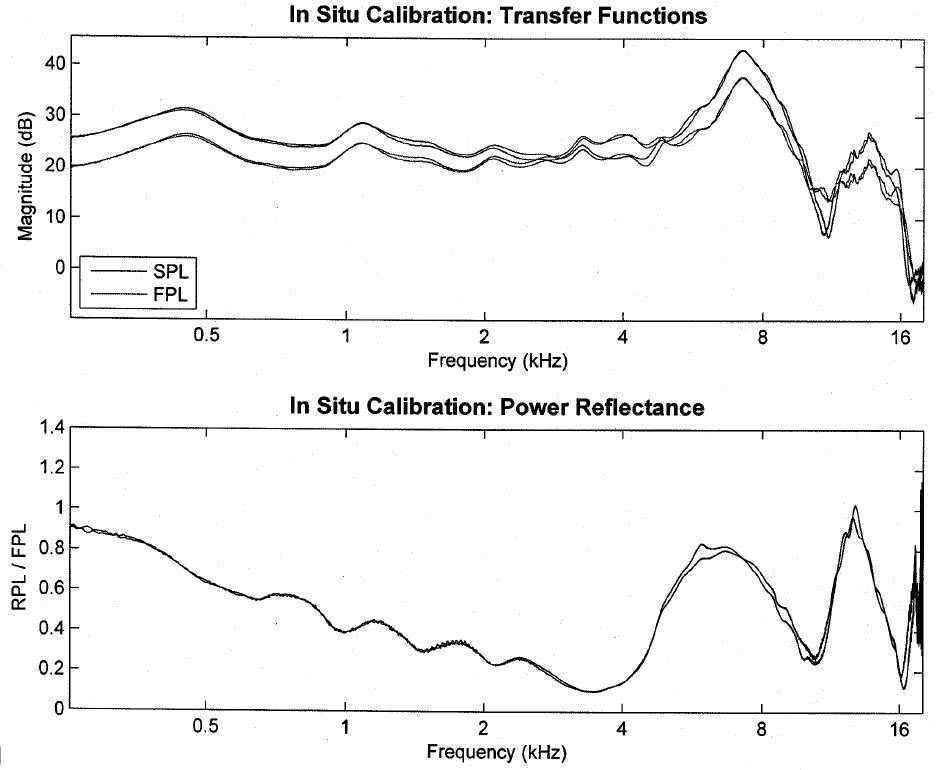 leftear_transferfunction.jpg
