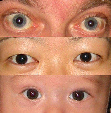 eyes2.jpg