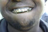 gold%20grill_small.jpg