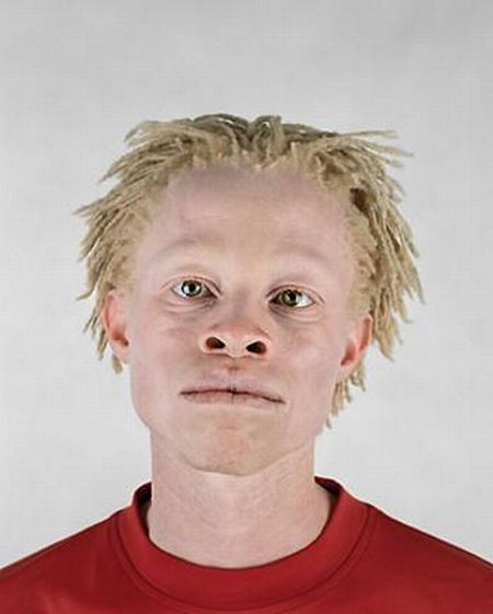 albino2.jpg
